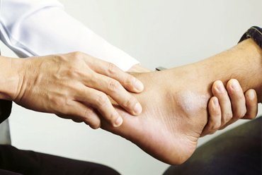 ANKLE FRACTURES
