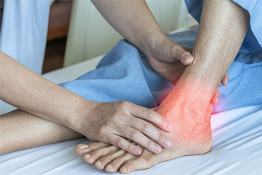 ANKLE ARTHRITIS