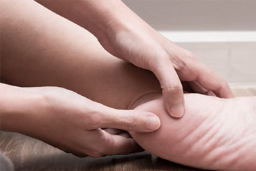 HEEL PAIN